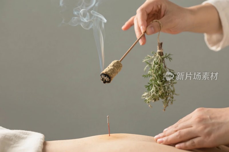 中医针灸治疗场景