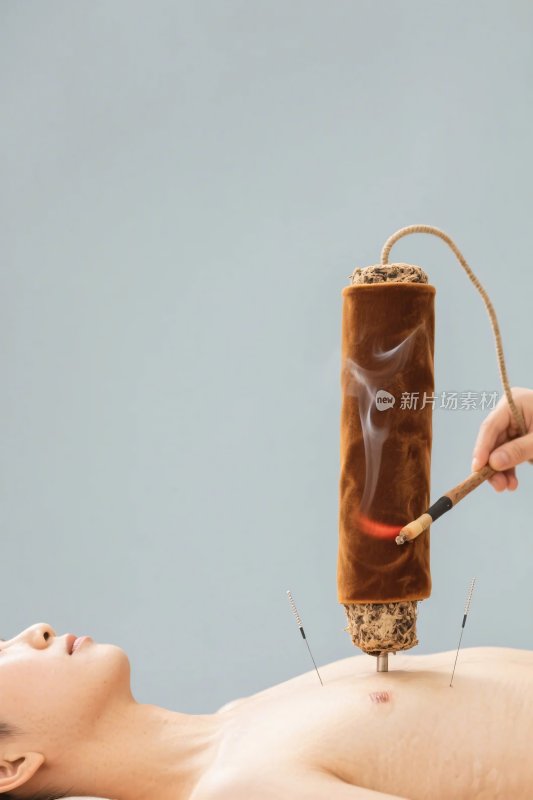 中医针灸艾灸治疗场景