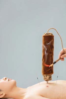 中医针灸艾灸治疗场景 中医针灸艾灸治疗场景