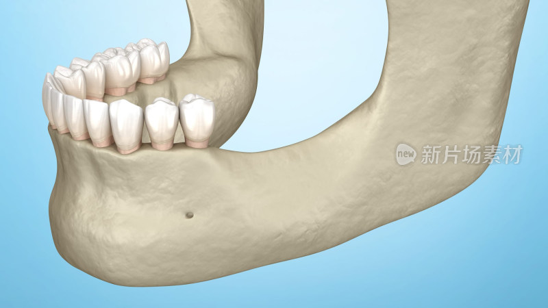 口腔整形口腔医学正畸整骨矫正下颌骨