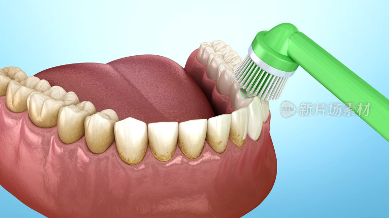 口腔医学口腔健康牙结石牙线刷牙牙齿清洁