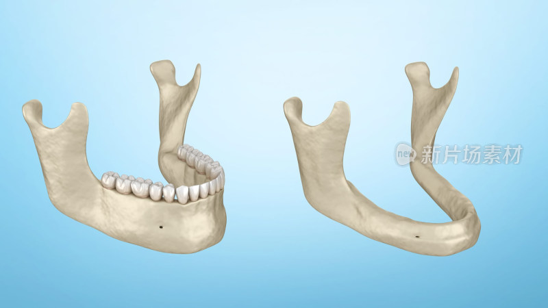 口腔整形口腔医学正畸整骨矫正下颌骨