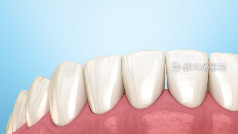 口腔医学牙齿牙体种植牙补牙烤瓷牙