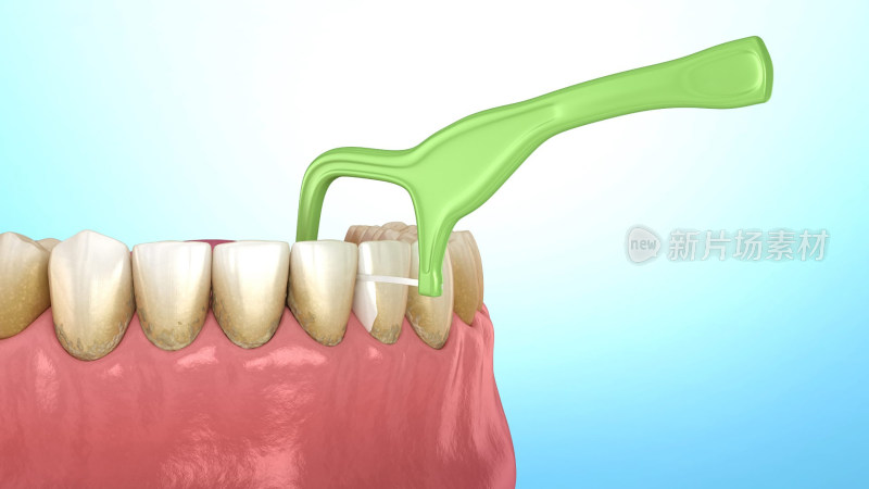 口腔医学口腔健康牙结石牙线刷牙牙齿清洁