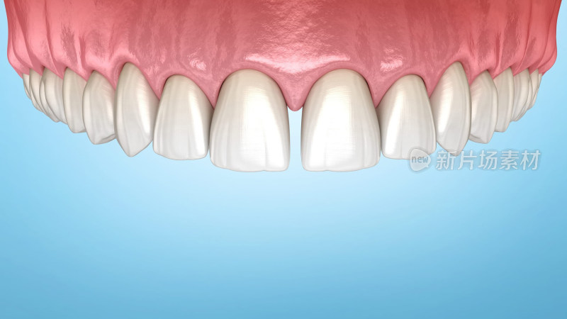口腔医学牙齿牙套牙体假牙插图