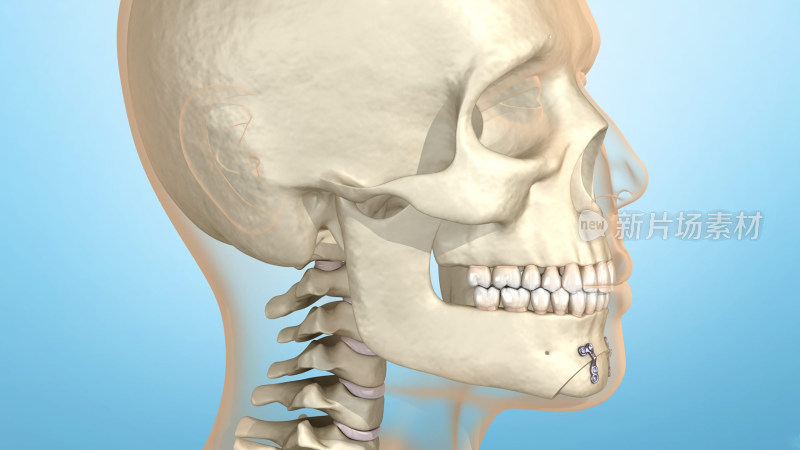 口腔整形口腔医学正畸整骨矫正下颌骨