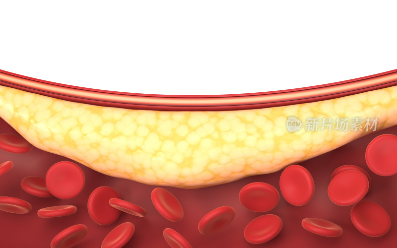 血管中的脂肪与红细胞 3D渲染