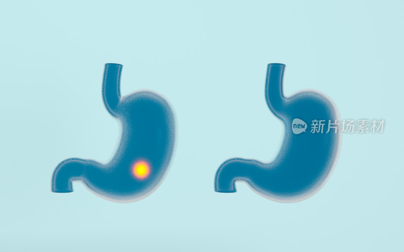 胃部图解 3D渲染