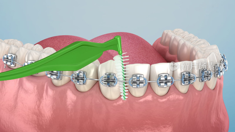 口腔医学口腔健康牙线刷牙牙齿清洁