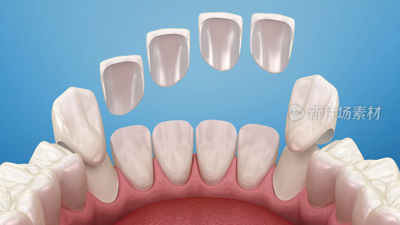口腔医学牙齿牙套牙体假牙插图