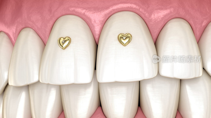 口腔医学牙齿牙科种植牙齿宣传插图