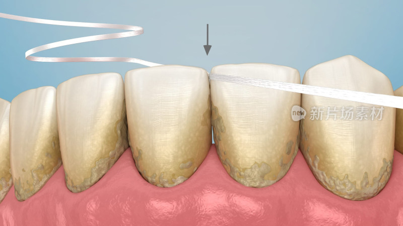 口腔医学口腔健康牙结石牙线刷牙牙齿清洁