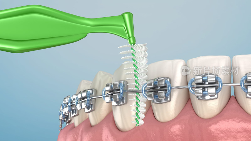 口腔医学口腔健康牙线刷牙牙齿清洁