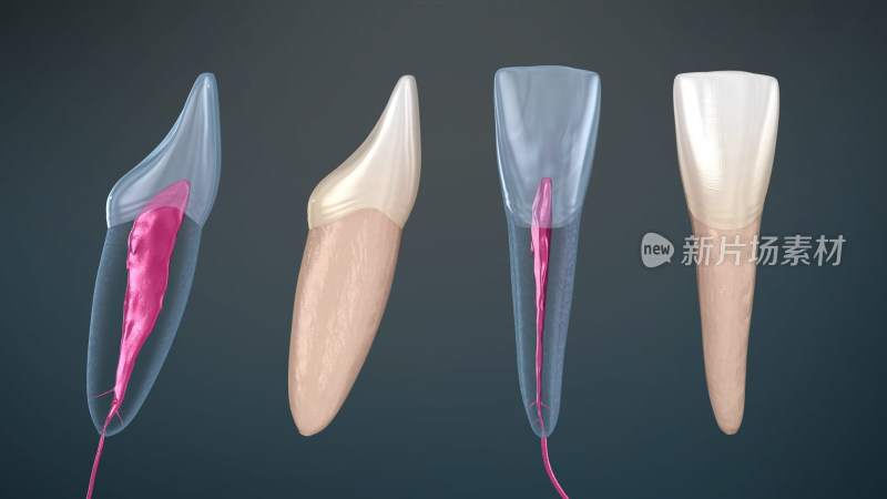 口腔医学牙齿牙科种植牙齿宣传插图